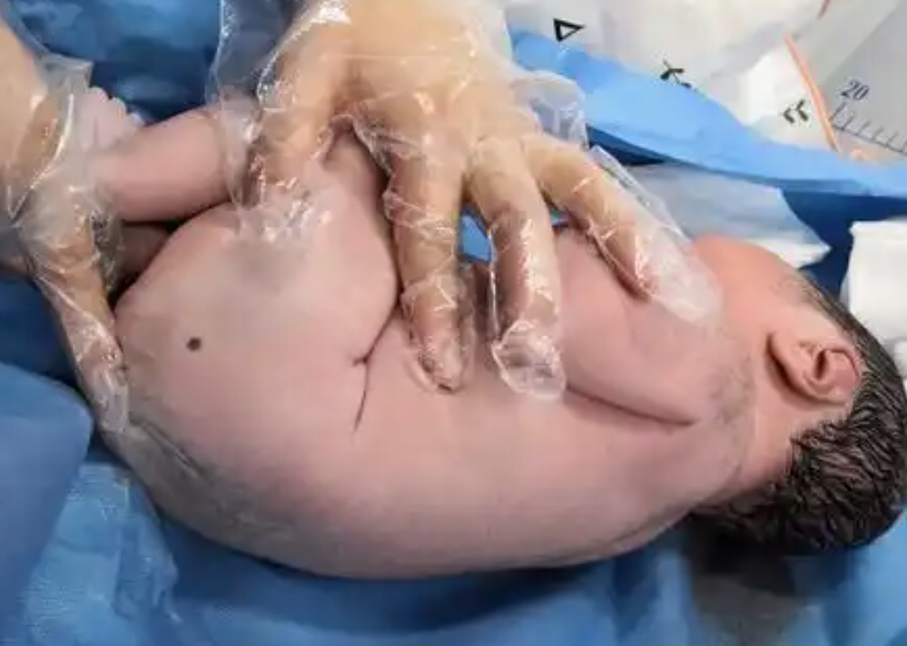 【图解】胎记的位置与命运关系，最全胎记算命